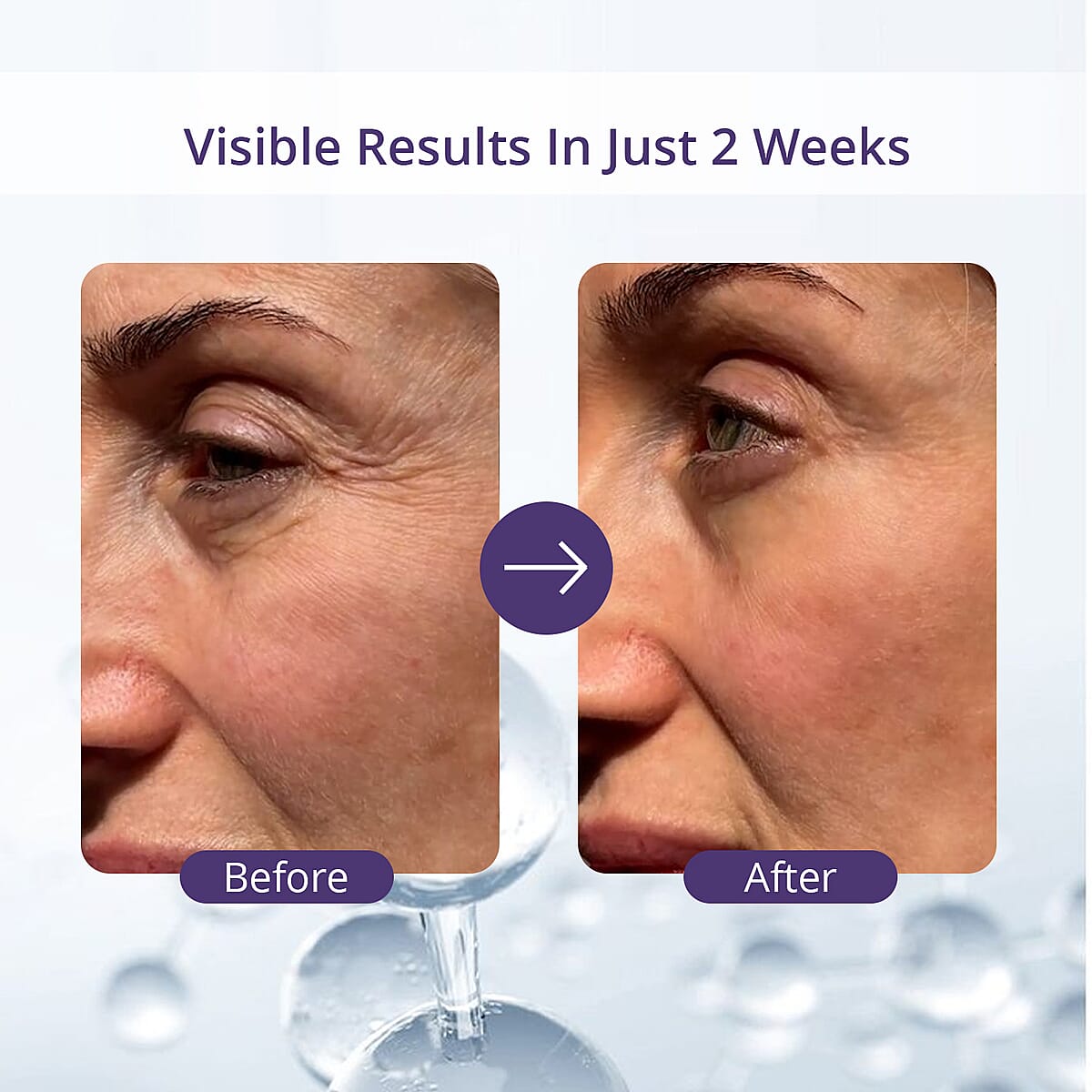 Doorbuster Dermalactives Ion Eye Wand (1 Year Warranty) image number 4