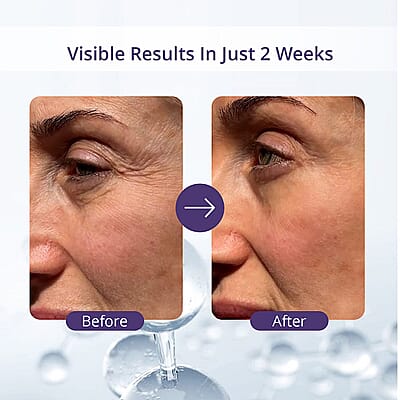 Dermalactives Ion Eye Wand (1 Year Warranty)