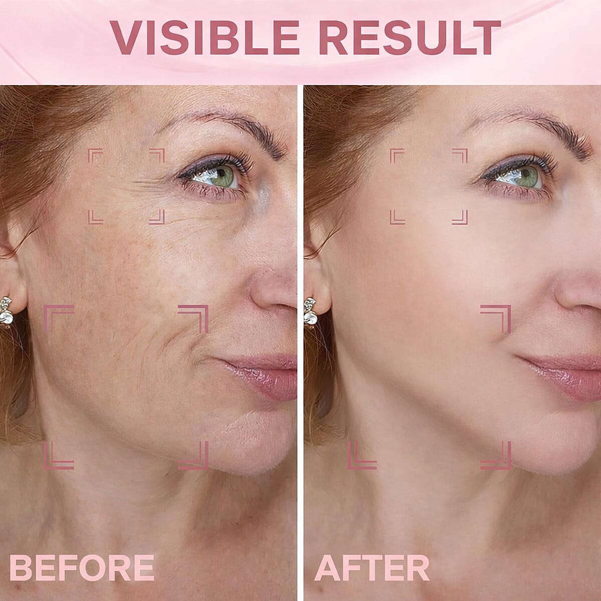 Pursonic 7-in-1 LED Light Therapy Beauty Device for Neck & Face image number 6