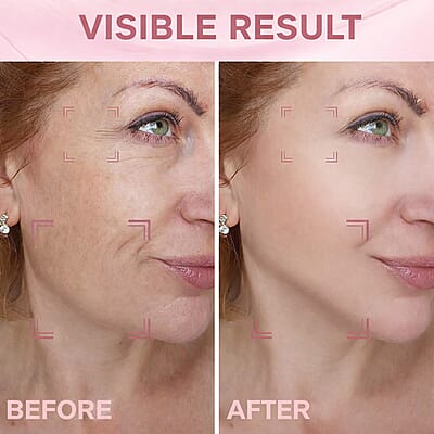 Pursonic 7-in-1 LED Light Therapy Beauty Device for Neck & Face