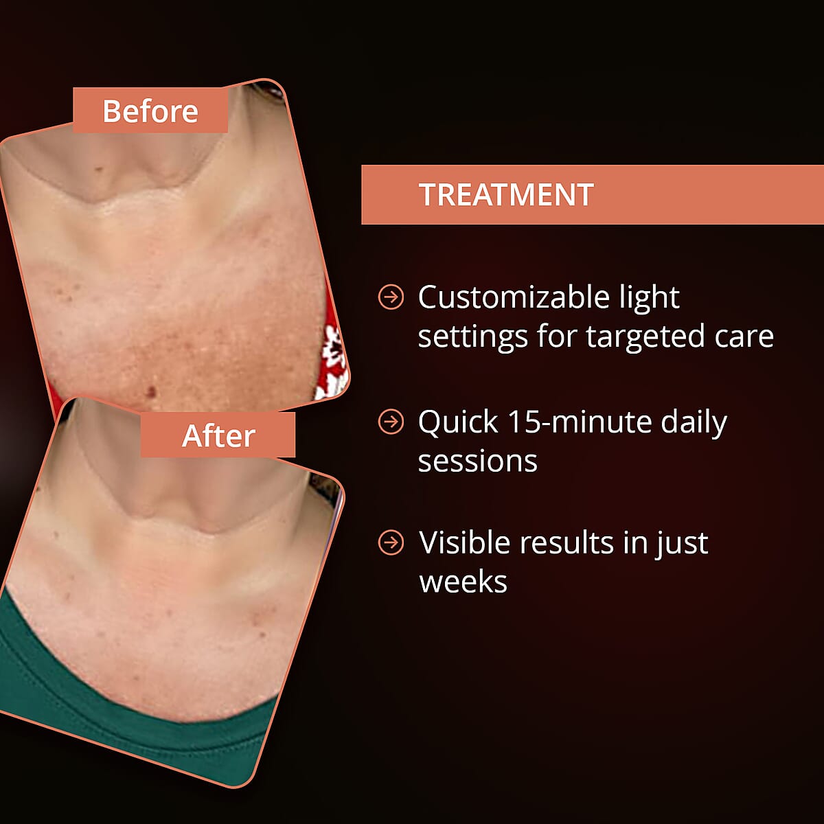  Numiere Feather Neck & Decollete LED Mask (Manufacturer Warranty) image number 4