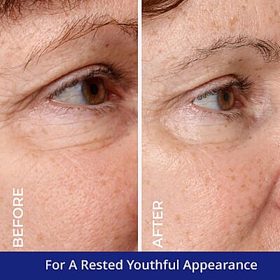 Clinical Results 24/7 Collagen Peptide Matrixyl Trifecta A.M. Eye Revive (1oz)