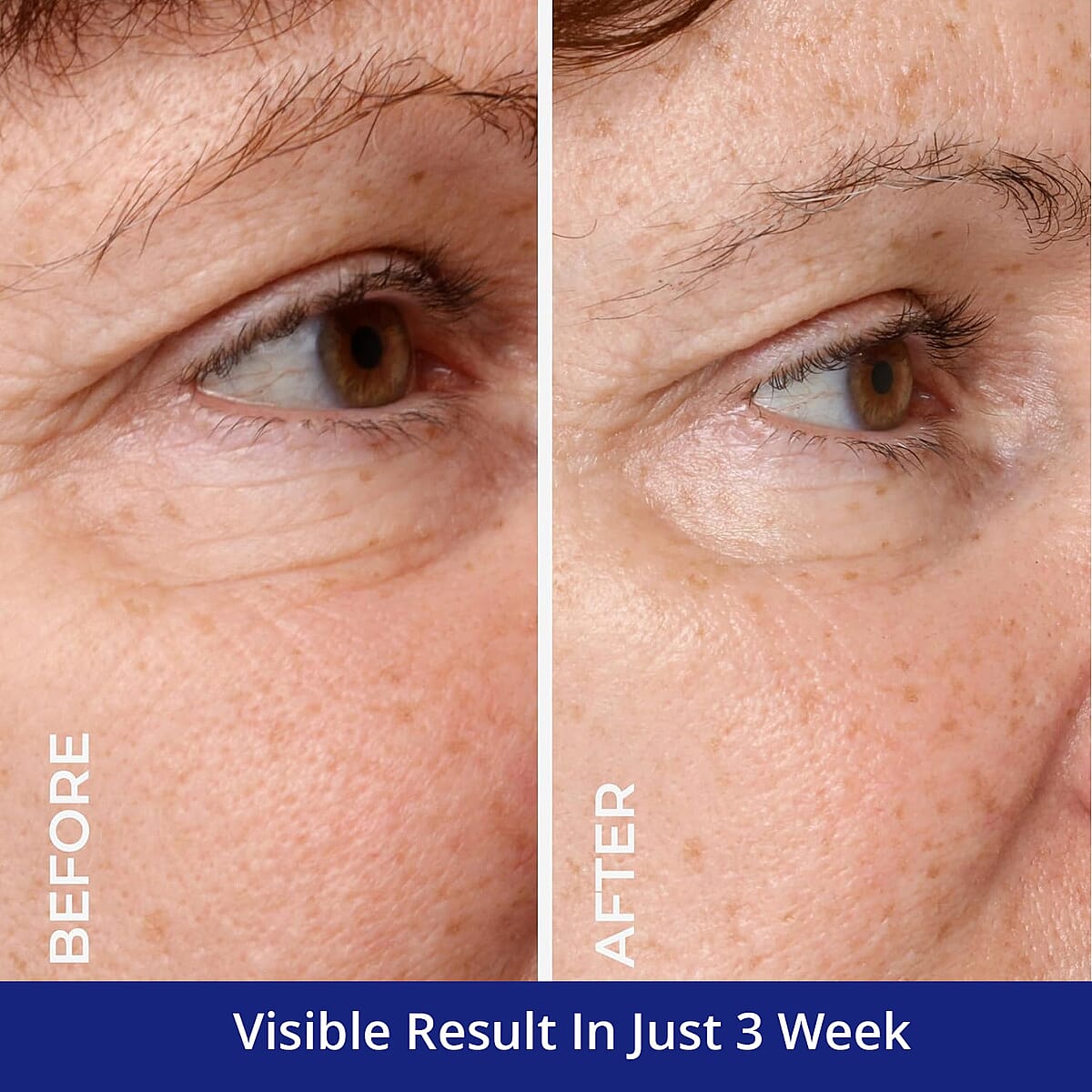 Clinical Results Matrixyl Collagen P.M. Eye Renew (1oz) image number 4