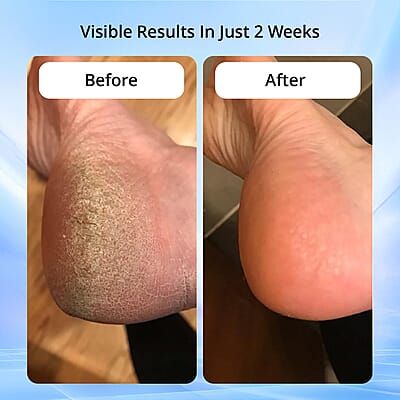 Electric Foot File with 2 Speed Adjustments