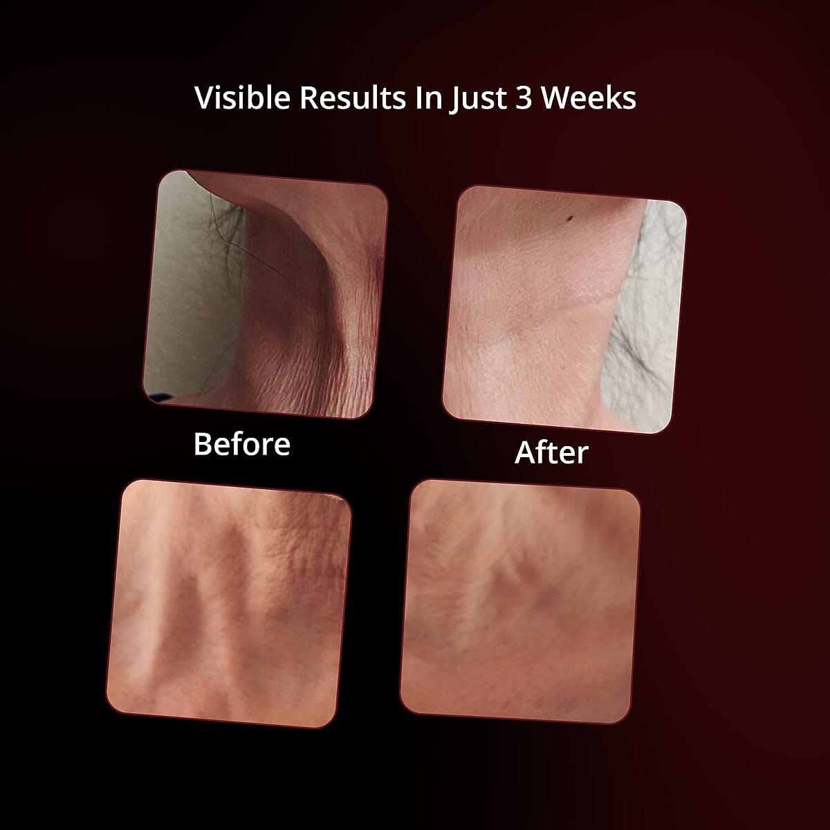 TLV Mega Clearance Doorbuster GLO24K 7 Color LED Super Mask for the Neck, Chest & D&eacute;collet&eacute; (Lifetime Warranty) image number 4