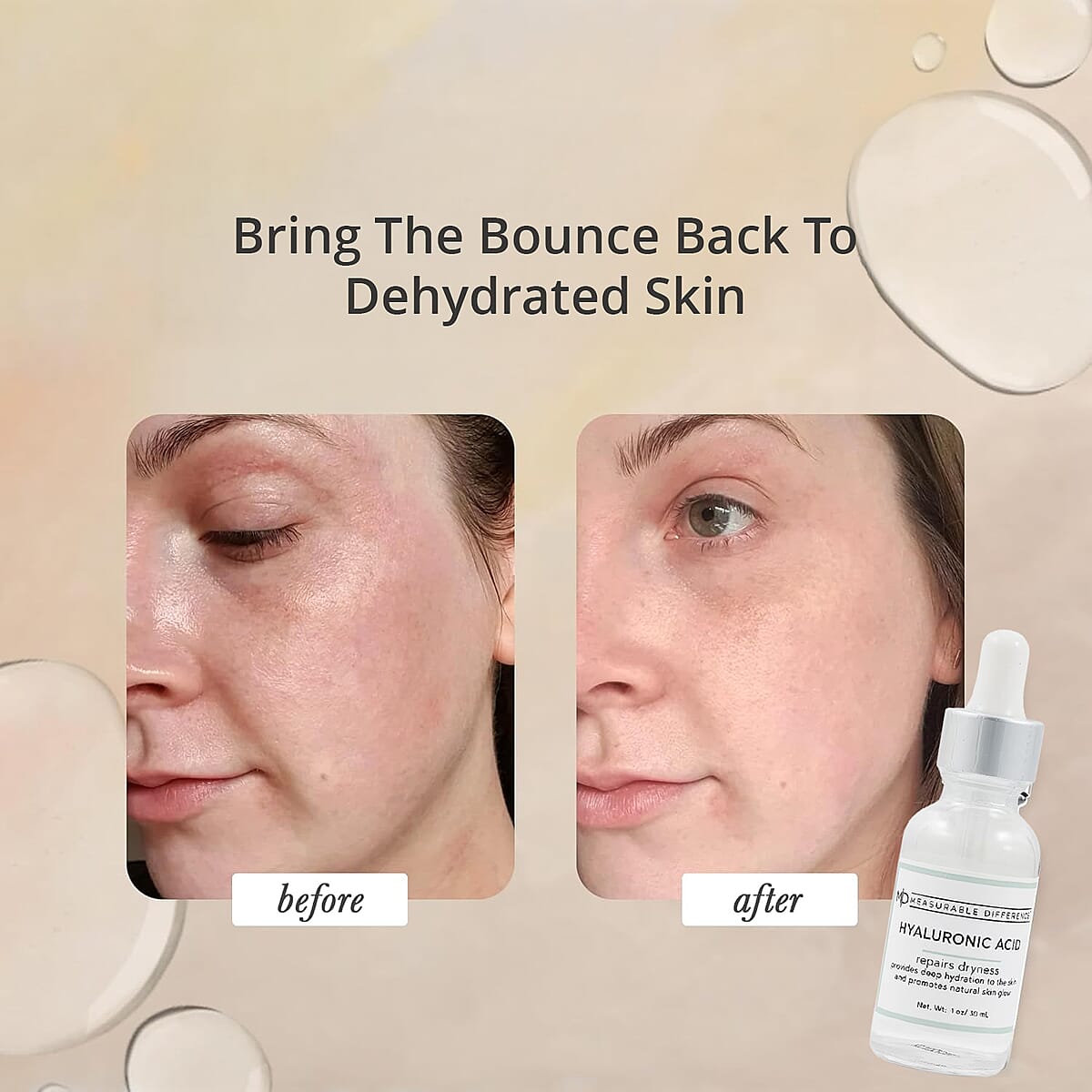 MD Hyaluronic Acid Serum 1 oz image number 5