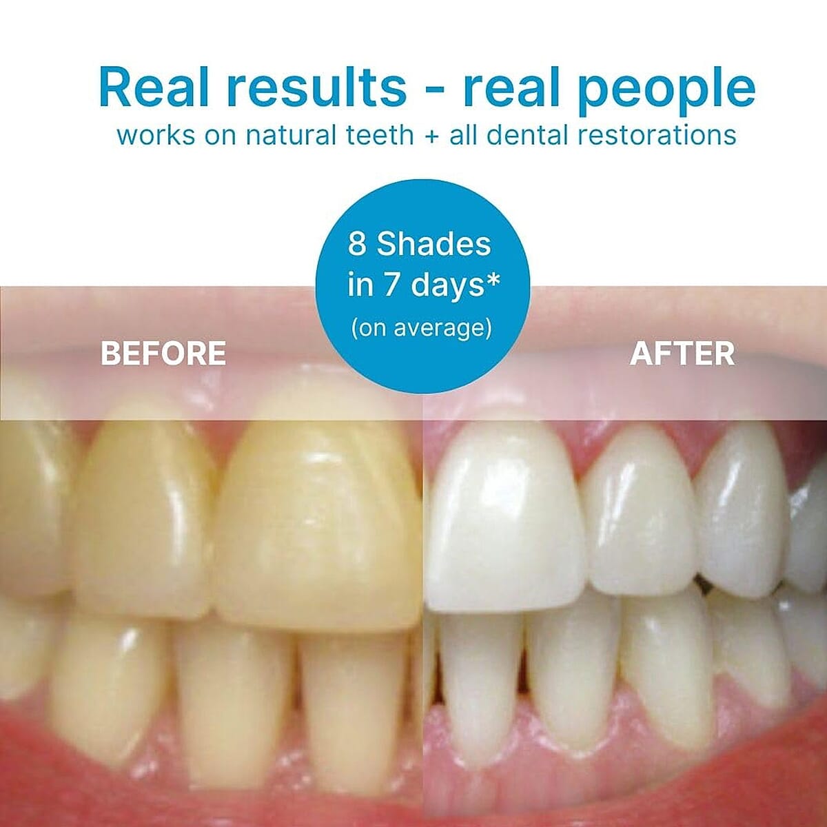 LAB Eclipse PAP Pro Expert Teeth Whitening Powder image number 5