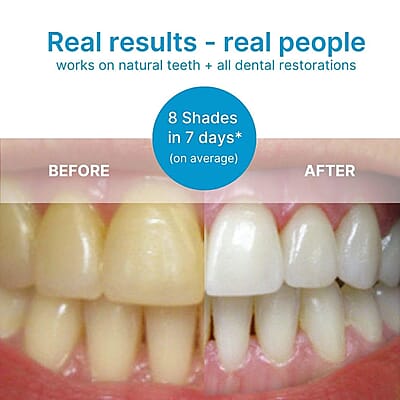 LAB Eclipse PAP Pro Expert Teeth Whitening Powder