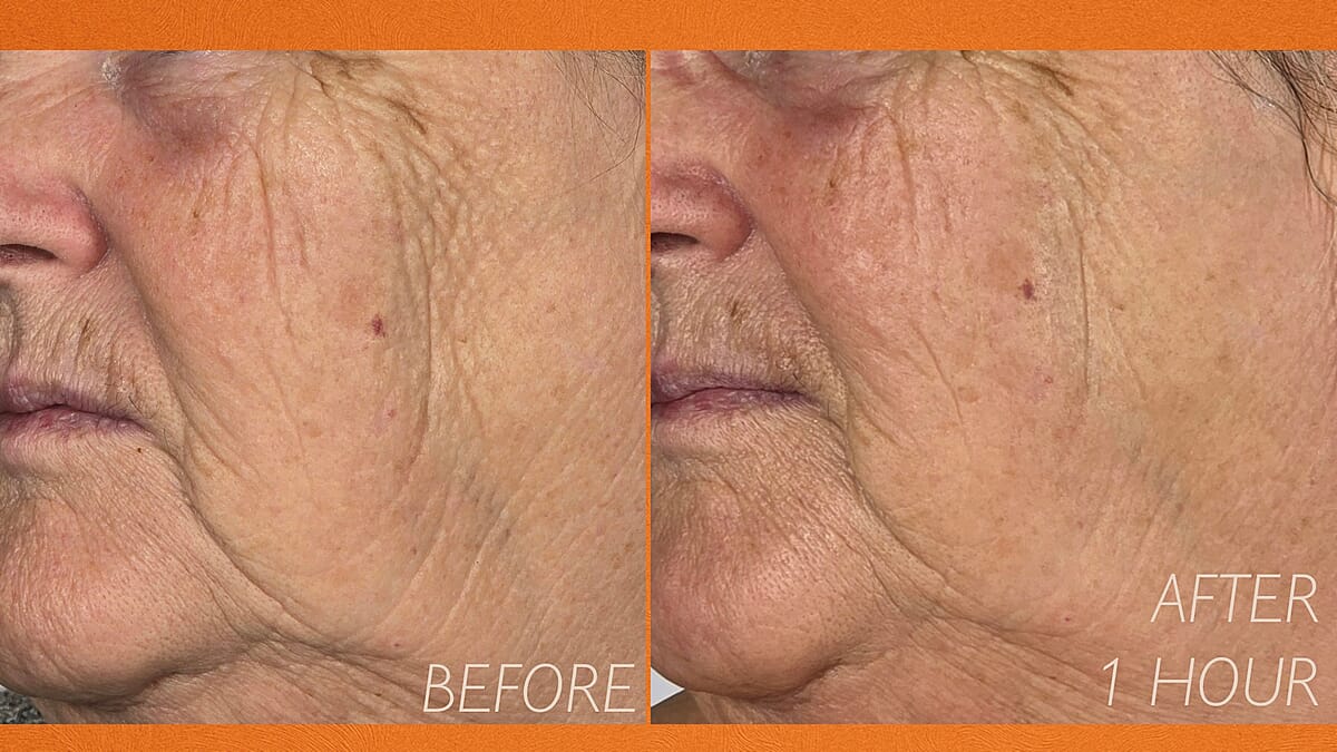 Doorbuster LAB Elysium Viscero Dermal Pure Source LED Face Mask (Lifetime Warranty) image number 6