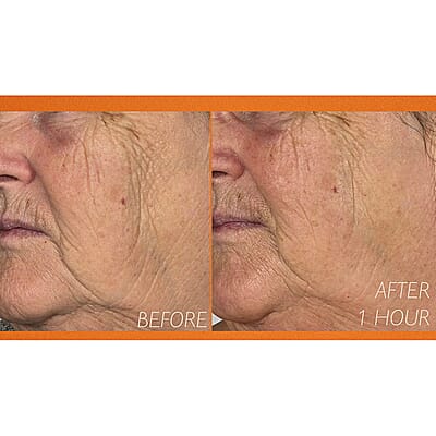 LAB Elysium Viscero Dermal Pure Source LED Face Mask (Lifetime Warranty)