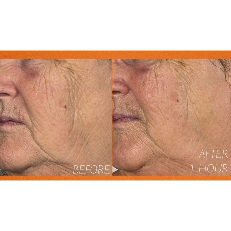 LAB Elysium Viscero Dermal Pure Source LED Face Mask (Lifetime Warranty)