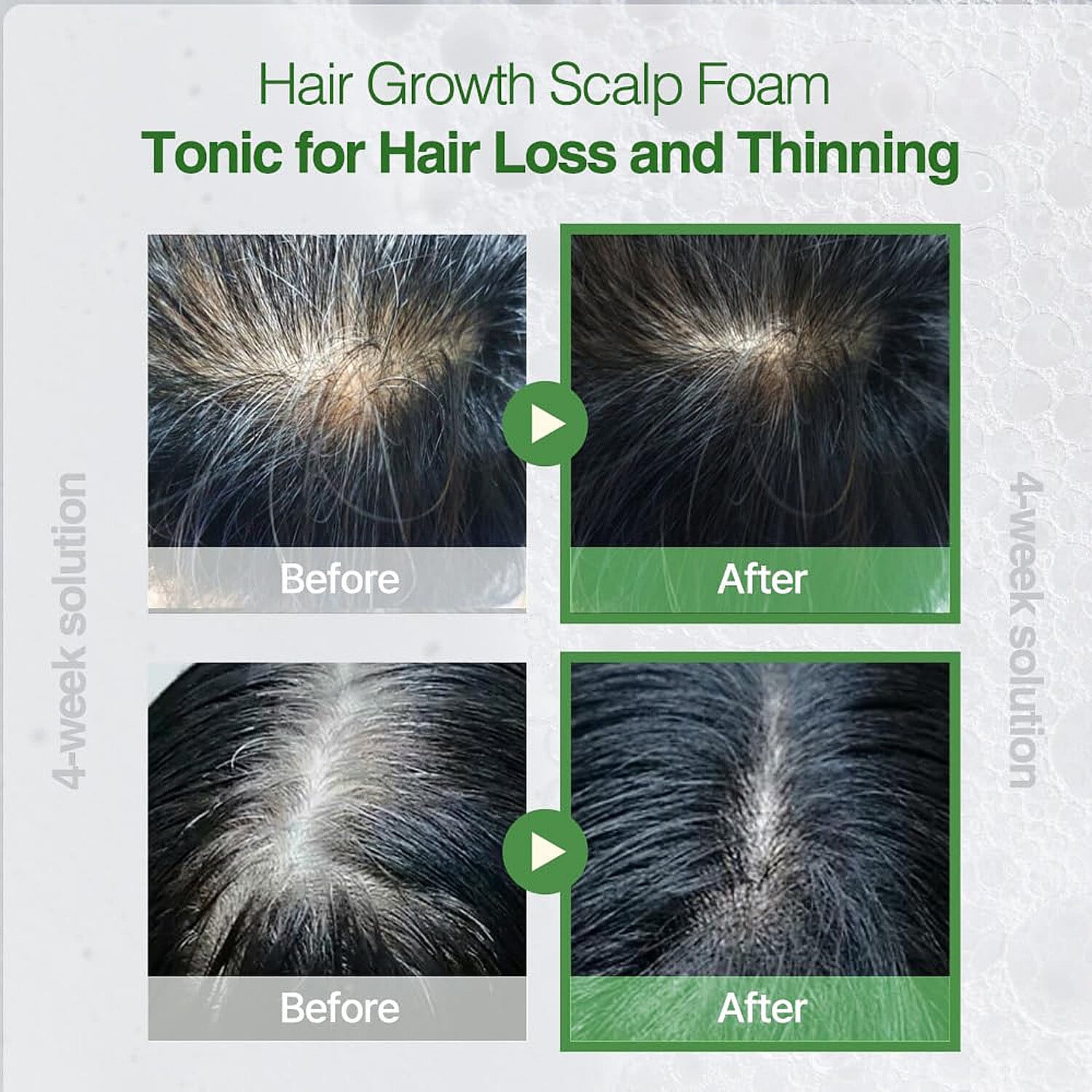 Rootonix Rosemary Scalp Tonic for Scalp Nutrition & Relief (3.38oz) Made in Korea