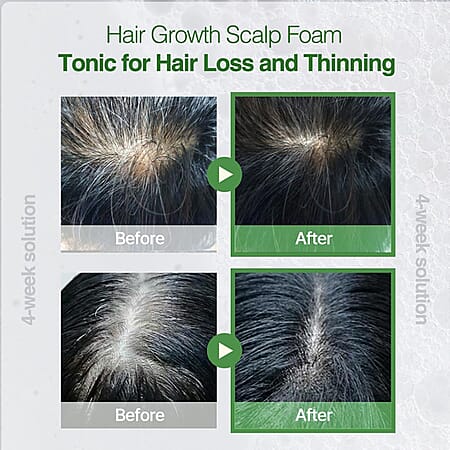 Default Title - Product card gallery slide 4 (10243620634937)