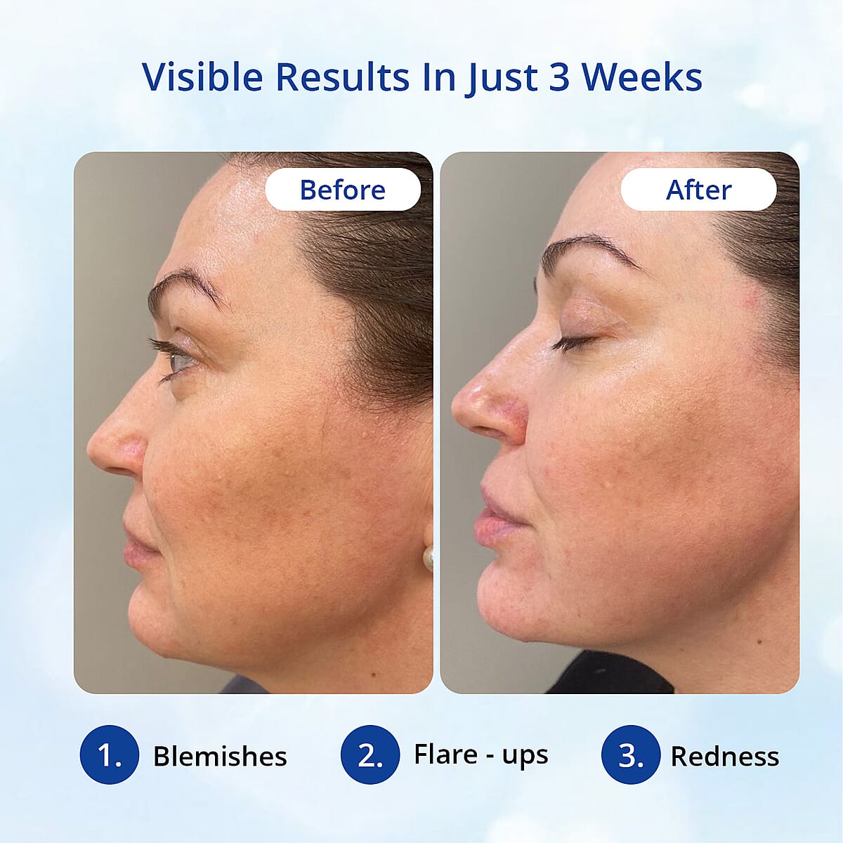 Fabulift Fabulous Eyes Lifting Serum 20ml image number 4