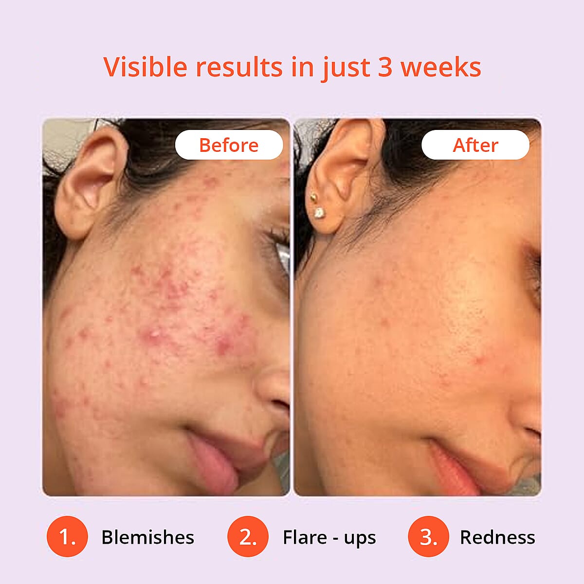 KHOLD Hypochlorous Acid Mineral Spray (3.17oz) image number 4