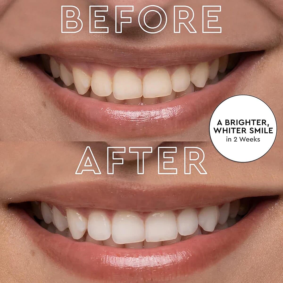 Teeth Whitening LED Kit, Black image number 5