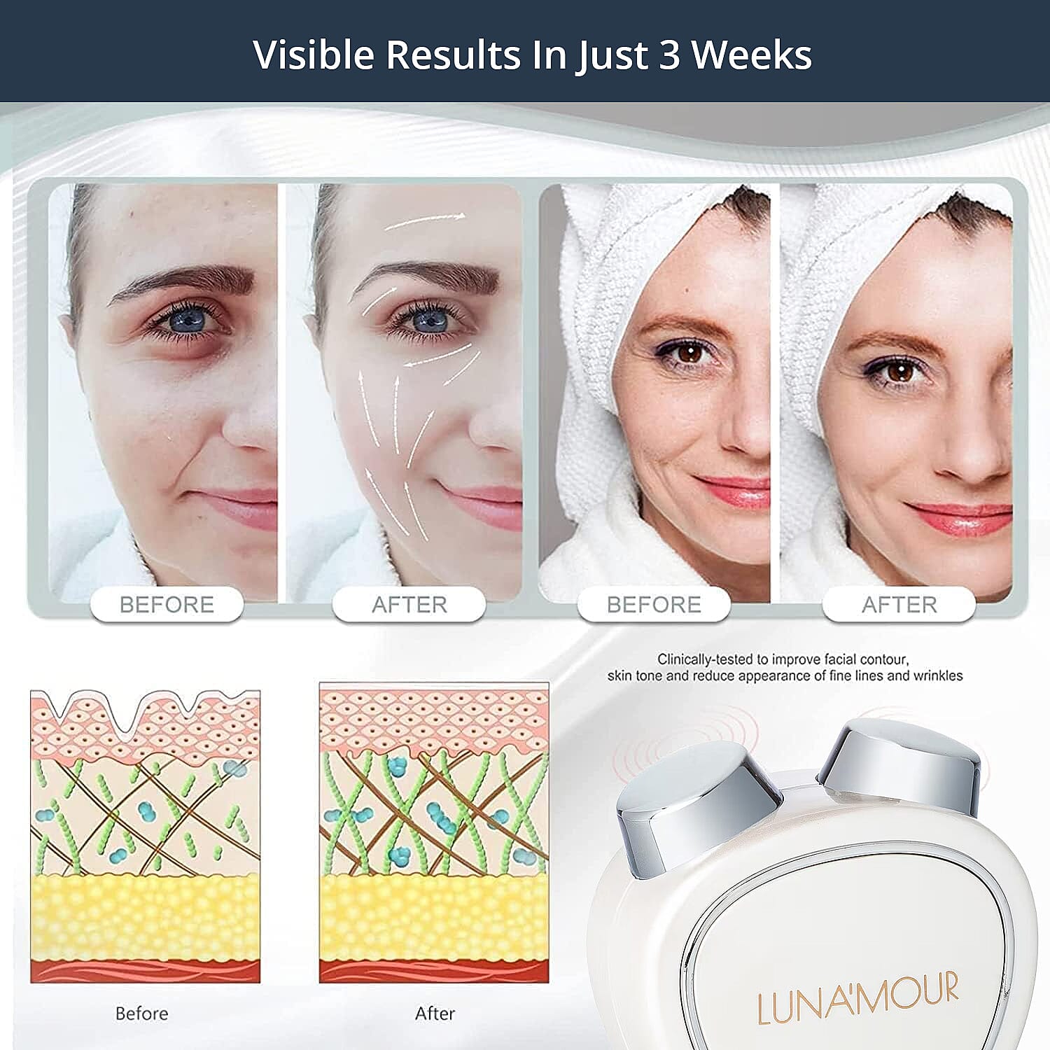 LUNA'MOUR  MicroMini Face Lift Beauty Tool