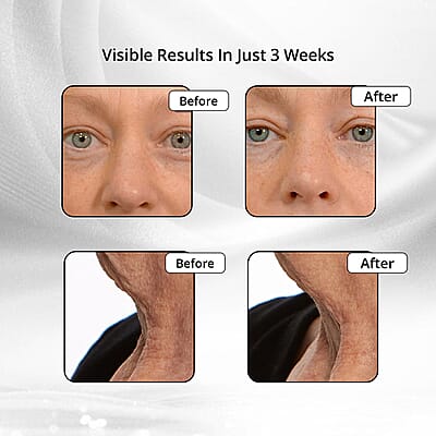 LAB Life & Beauty Titan Gold Eight Technology Ultimate Face & Body Device (Lifetime Warranty)