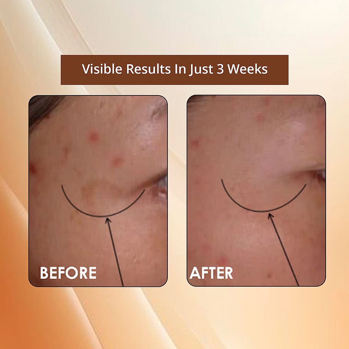 Clinical Results 24/7 Nutrient-Rich Plasma Winter Recovery (Ships in 5-7 Days) image number 4