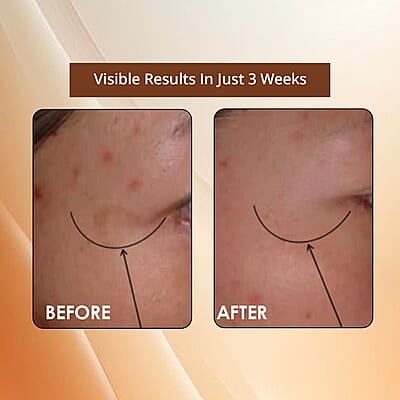 Clinical Results 24/7 Nutrient-Rich Plasma Winter Recovery