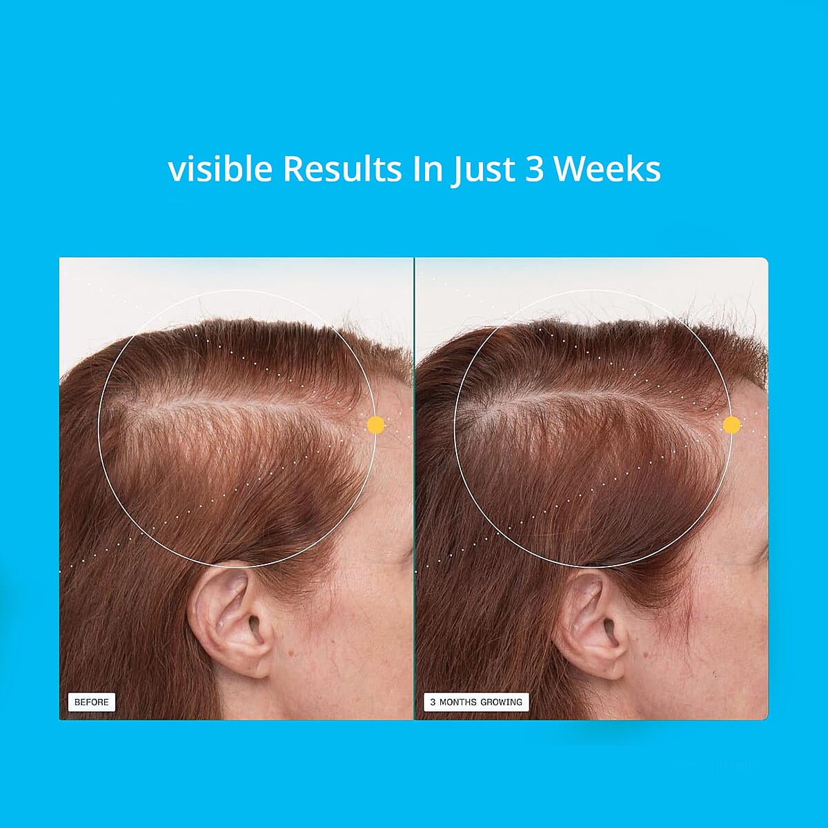 Joyce Giraud Ultimate Hair Strength Supplements, 60-Day Supply, 120 Capsules image number 5