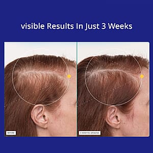 Joyce Giraud Ultimate Hair Strength Pro Dietary Supplement (90 Days Supply, 180 Capsules) Made in US (Ships in 7-10 Days)