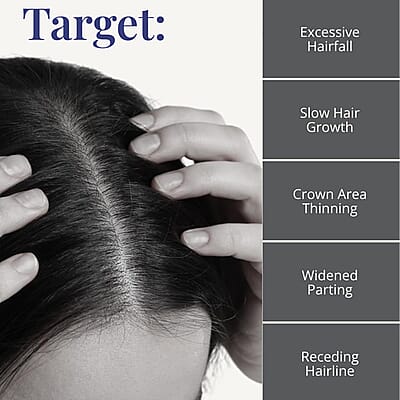 Clinical Results 24/7 Matrixyl Trifecta Collagen Peptide Scalp Treatment Vials with Micro-Needling Applicator (4x .34oz) Made in US