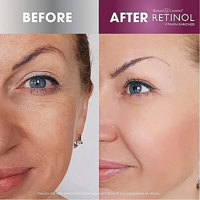 Retinol Instant Radiance Booster