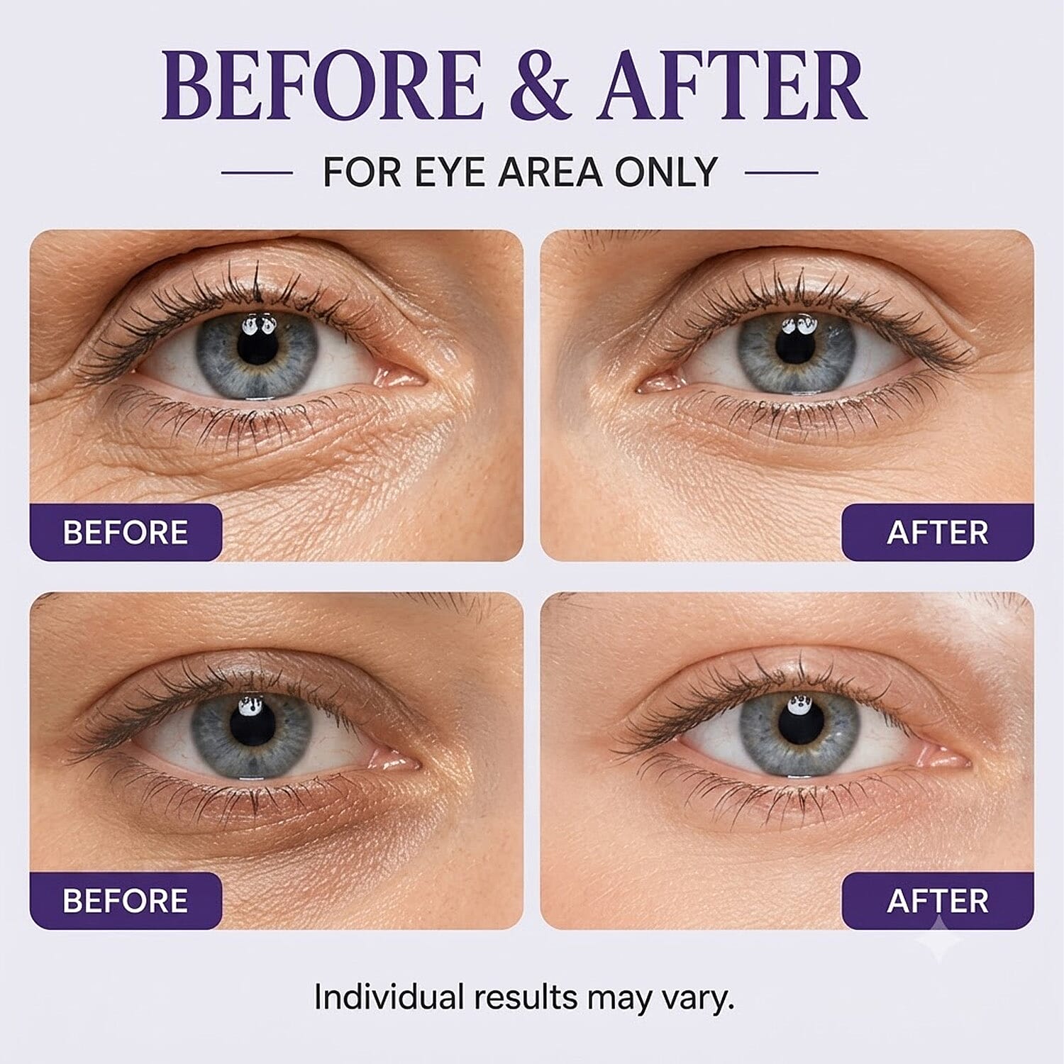 Clinical Results 24/7 Zero Gravity - Renew / Total Eye Cream