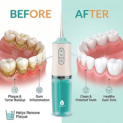 Pursonic USB Rechargeable Water Flosser -White