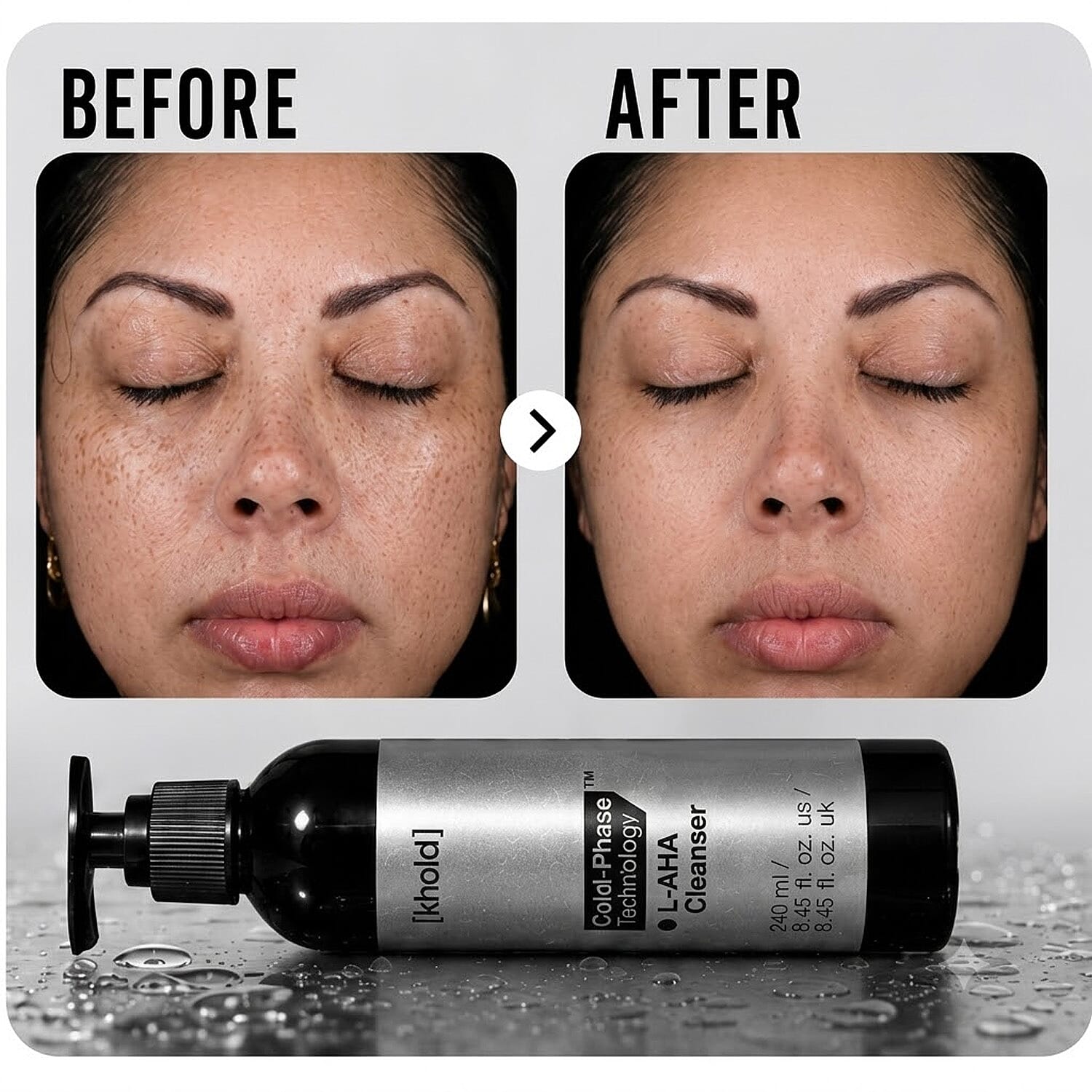 Khold L-AHA Cleanser 240ml