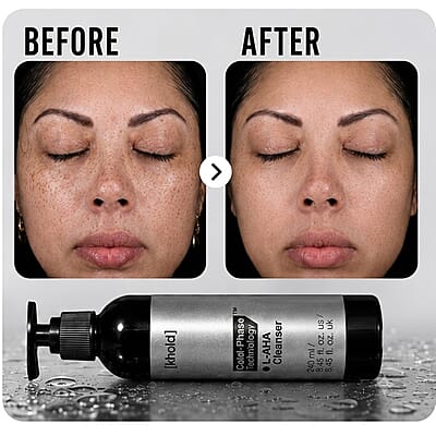 Khold L-AHA Cleanser 240ml