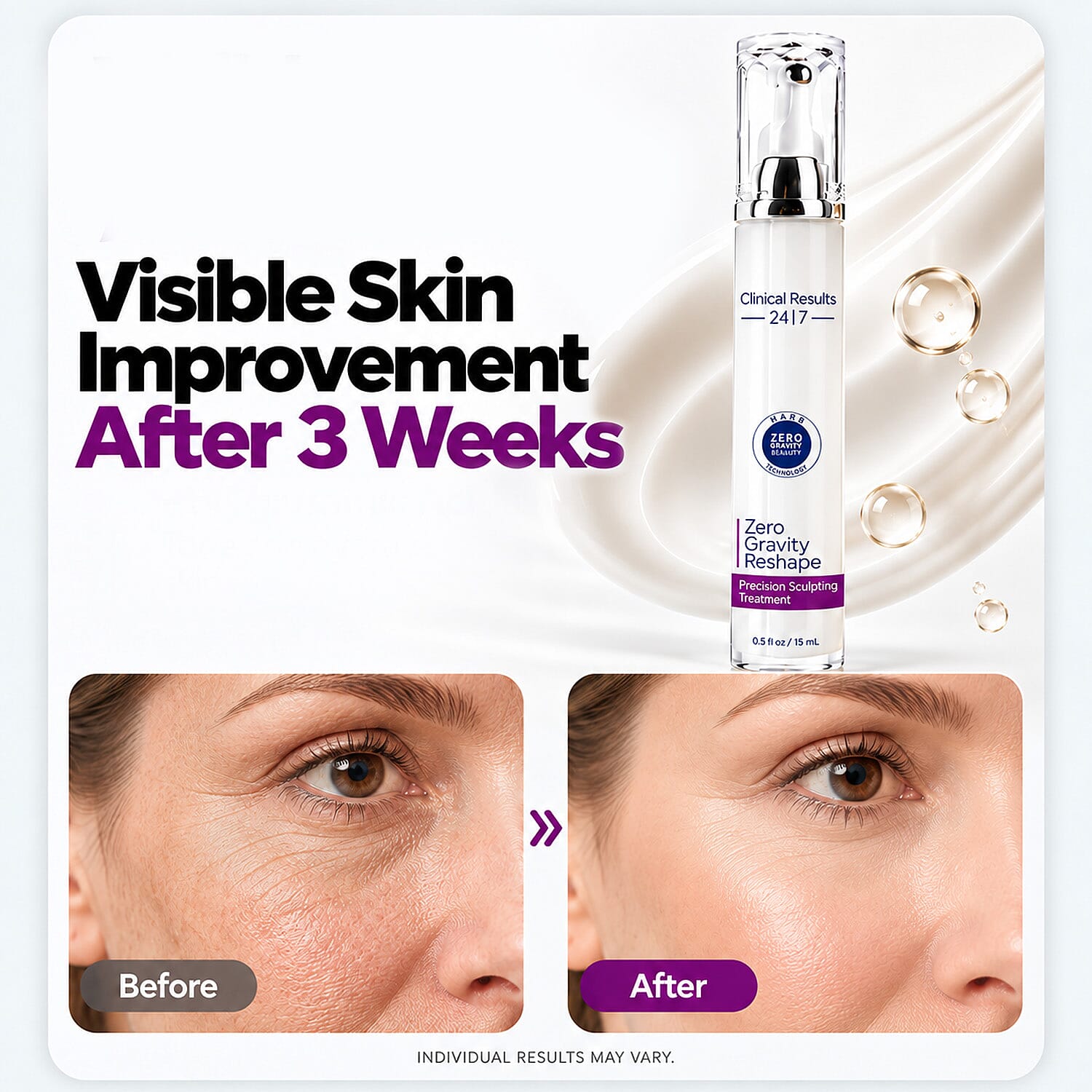 Clinical Results 24/7 Zero Gravity -Reshape / Precision Sculpting Treatment