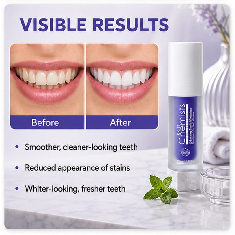 Skin Chemists X-Exteme Teeth Whitening Toothpaste