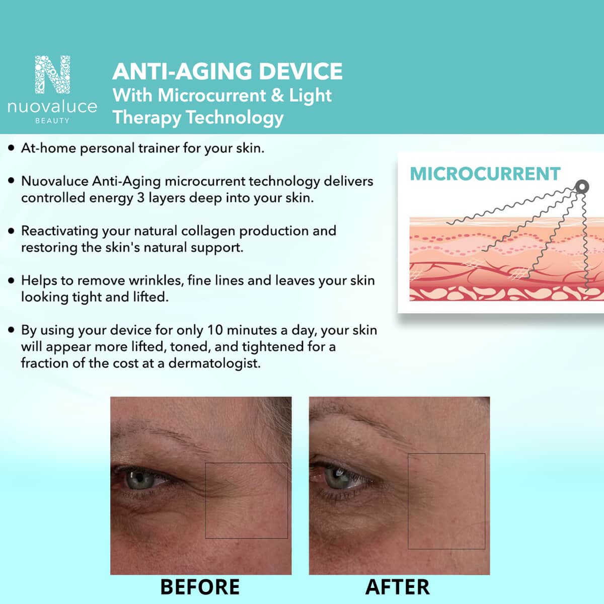 Nuovaluce Anti Aging Microcurrent & Red Light Therapy Device Wrinkle Reducing & Skin Tightening Device Handheld Skin Care Machine to Lift image number 4
